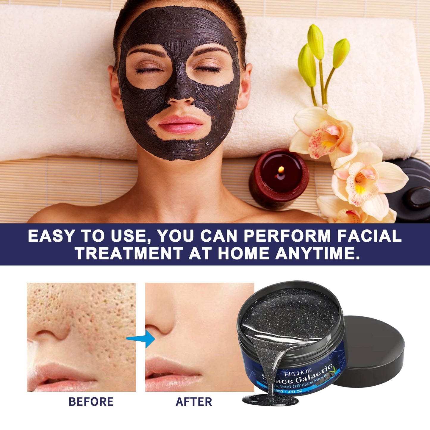 Blackhead removal mask